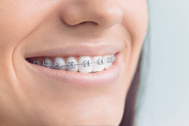 Best Invisalign and Clear Aligners  in Ingleside, TX